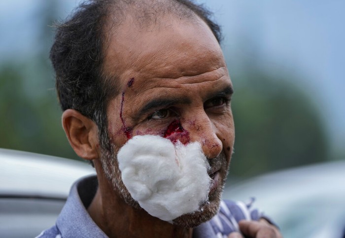India Kashmir Animal Attack A Kashmir wildlife official holds a tranquilizer dart as they search for a wild bear after a civilian was injured in its attack in Srinagar, Indian controlled Kashmir, Sunday, Sept. 11, 2022. (AP Photo/Mukhtar Khan)