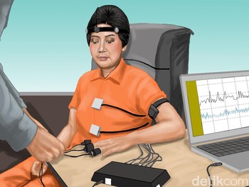 Janggal Kekerasan Seksual Istri Sambo