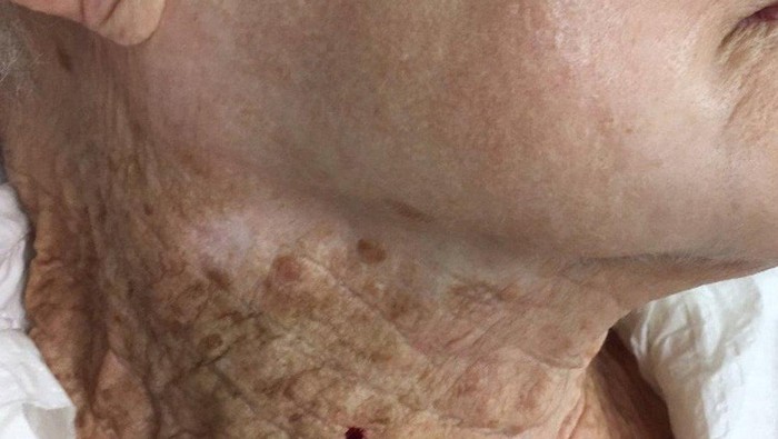 Viral pakai sunscreen dan tidak Viral pakai sunscreen dan tidak
