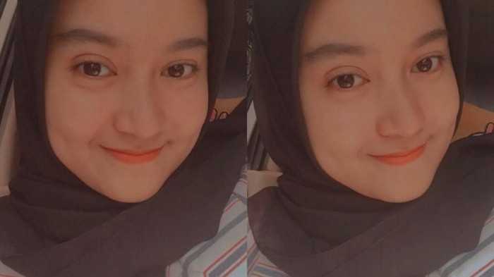 Viral wanita kena tumor otak