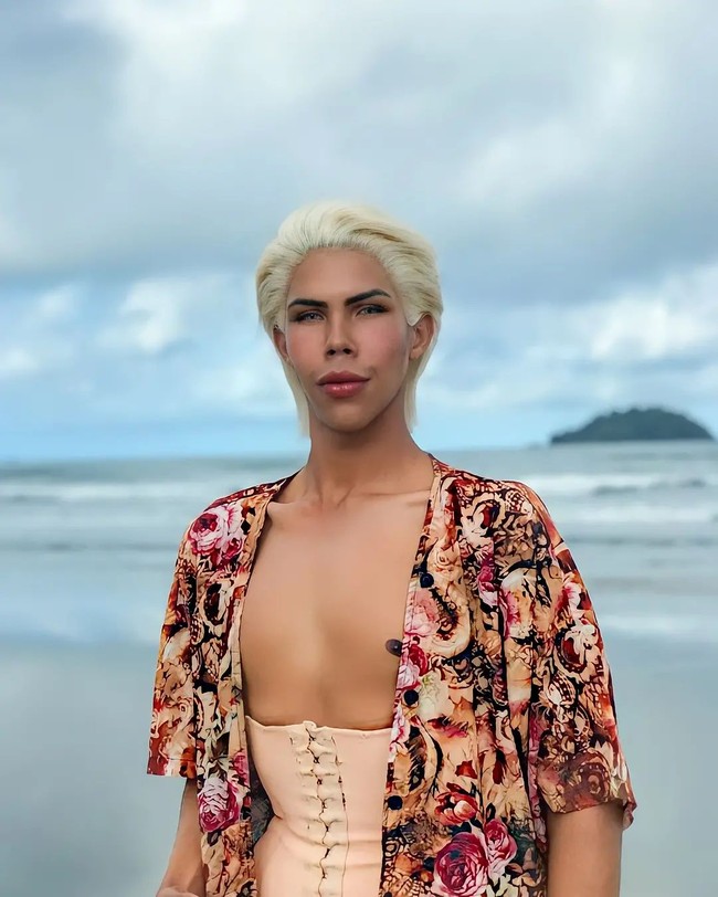 Felipe terpikir untuk operasi dan mulai mengumpulkan uang sejak usia 16 tahun. Ketika itu, pria yang kini berusia 18 ini sempat mendapat tentangan dari orang tua meski akhirnya ibunya menerima. Foto: Instagram @felipe_adam