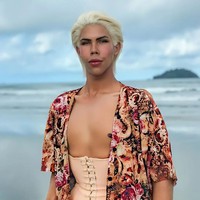 Felipe terpikir untuk operasi dan mulai mengumpulkan uang sejak usia 16 tahun. Ketika itu, pria yang kini berusia 18 ini sempat mendapat tentangan dari orang tua meski akhirnya ibunya menerima. Foto: Instagram @felipe_adam