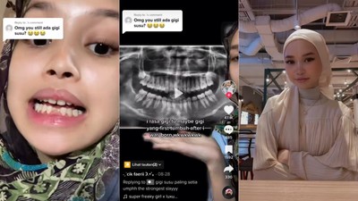Perempuan 18 Tahun Masih Punya 2 Gigi Susu, Begini Penampakannya