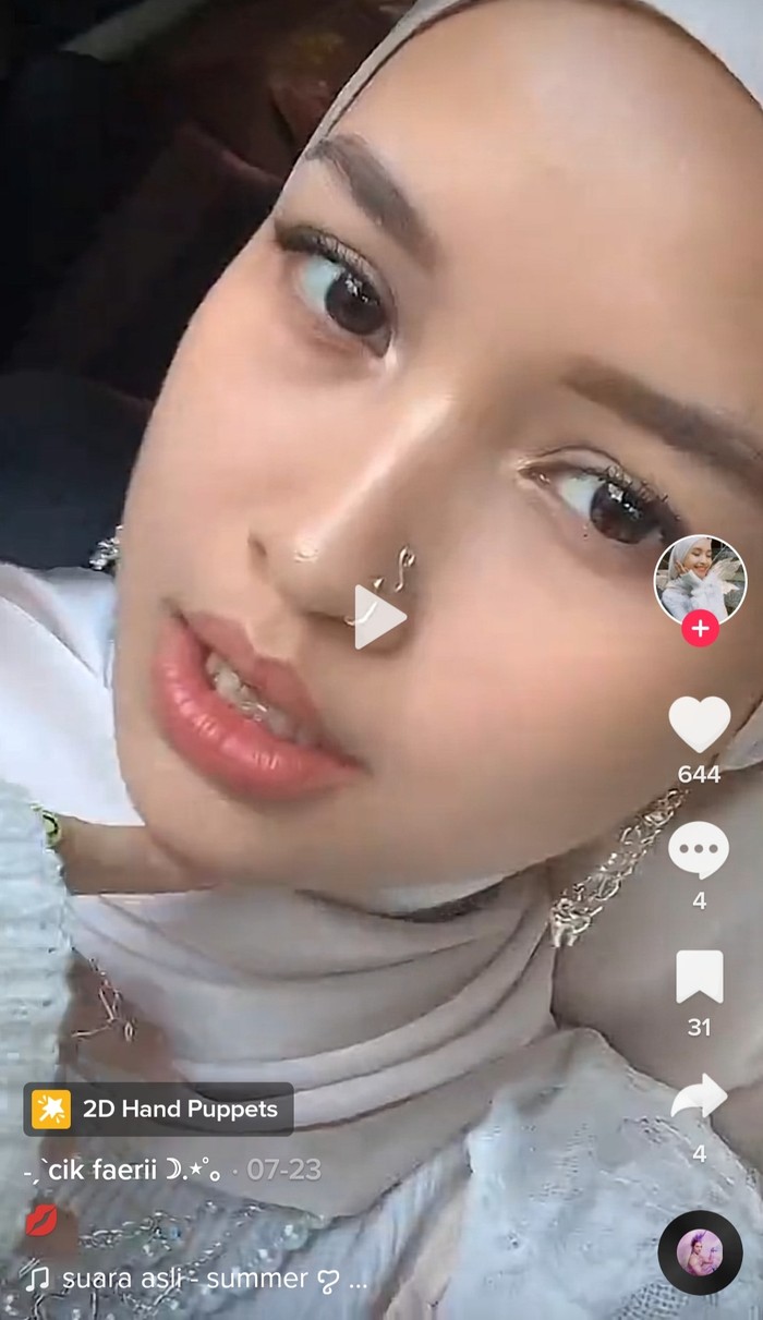 Perempuan 18 Tahun Masih Punya 2 Gigi Susu, Begini Penampakannya