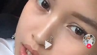 Walaupun dokter menyarankan untuk dibehel, saya tidak ingin melakukannya karena gigi ini sekarang seperti sudah menjadi identitas diri saya sendiri, tutur dia. (Tangkapan Layar Tiktok/ @le.naqi)