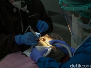 3 Ribu Puskesmas Tak Punya Dokter Gigi, Menkes Sentil Lulusan FKG