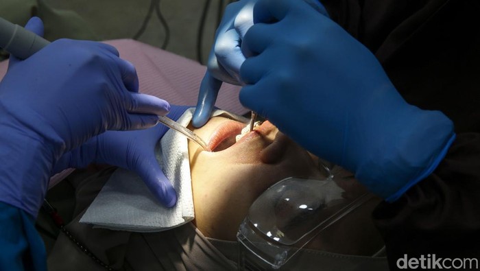 Kata PDGI soal DNM, Disebut Picu Kematian di Kasus Viral Gigi Bolong