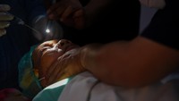 Dokter memeriksa pasien saat melakukan proses operasi katarak.