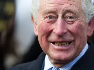 Jari Bengkak Raja Charles III Disorot, Dokter Ungkap Kemungkinannya