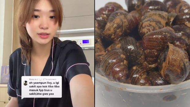 Livy Renata masuk rumah sakit karena masuk tutut