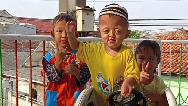 Muhammad Ar Rasyid (berbaju kuning) menderita Sindrom Apart Sindaktili. Yuk, bantu Rasyid dengan donasi di berbuatbaik.id.