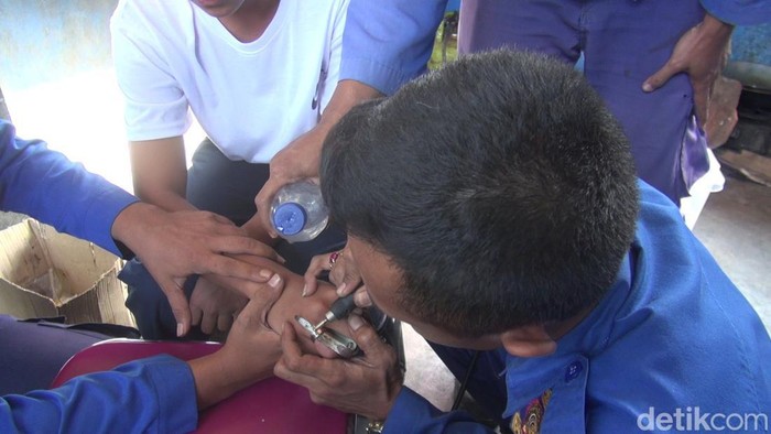 Proses pelepasan cincin di jari pelajar Subang.