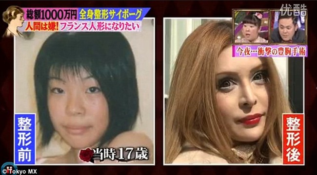 Sejak itu, Vanilla mulai merambah bagian lain, seperti hidung kemudian tubuh. Aku tidak senang dengan semua bagian tubuhku jadi aku melakukan semuanya, katanya dilansir 8days.Foto: Dok. Tokyo MX