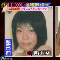 Sejak itu, Vanilla mulai merambah bagian lain, seperti hidung kemudian tubuh. Aku tidak senang dengan semua bagian tubuhku jadi aku melakukan semuanya, katanya dilansir 8days.Foto: Dok. Tokyo MX