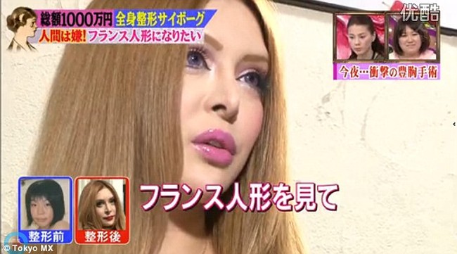 Dilaporkan Vanilla sudah menjalani lebih dari 30 prosedur kecantikan. Ia sendiri mengaku tidak menyarankan operasi plastik pada orang lain sebelum memeriksakan diri terlebih dahulu ke dokter.Foto: Dok. Tokyo MX