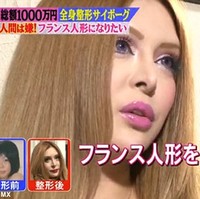 Dilaporkan Vanilla sudah menjalani lebih dari 30 prosedur kecantikan. Ia sendiri mengaku tidak menyarankan operasi plastik pada orang lain sebelum memeriksakan diri terlebih dahulu ke dokter.Foto: Dok. Tokyo MX