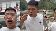 Sengaja Makan Lebah Agar Bibirnya Seksi, Influencer China Ini Dikecam
