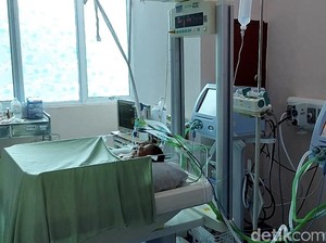 Bayi Kembar Siam 2 Kepala 1 Tubuh di Padang Kritis