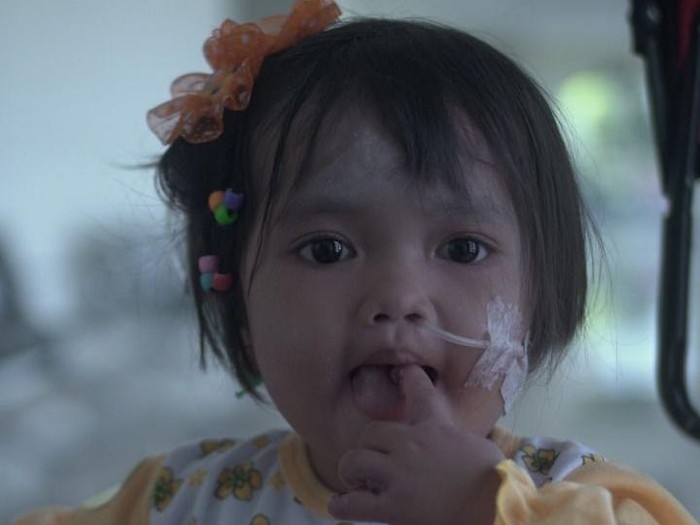 Eliza Laila Rahma menderita Epidermolisis Bullosa atau kelainan genetik langka yang menyebabkan kulit rapuh. Yuk, bantu Eliza lewat donasi di berbuatbaik.