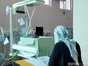 Kabar Duka, Bayi Kembar Siam 2 Kepala 1 Badan Asal Pariaman Meninggal