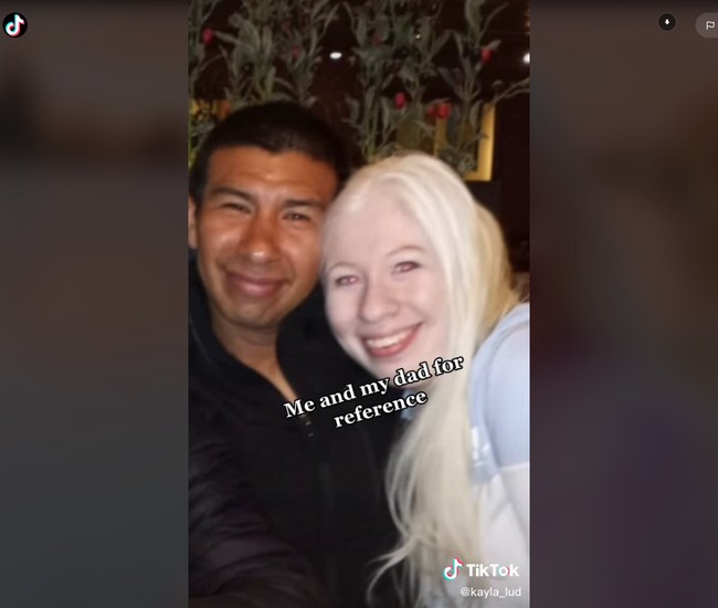 Karena itu, Kayla ingin mengedukasi orang mengenai kondisinya. Tujuan terbesarku adalah mengedukasi dan membangun kepercayaan diri terkait albino karena secara umum kebanyakan orang di dunia mengkategorikan kita. Kami sepertinya sangat berbeda dari yang lain seperti spesia lain, ungkapnya.Foto: Instagram/TikTok @kayla_lud