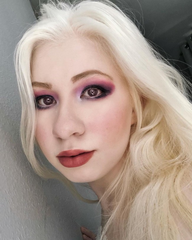 Aku mendengar reaksi negatif dari orang-orang yang bilang aku terlalu menonjol atau terlalu terang untuk mereka ketika aku berdiri di bawah sinar matahari yang mana aku pikir itu lucu. Satu-satu reaksi yang paling membuat kesal sedikit adalah saat orang berpikir aku berbohong atau salah tentang rambut, mata, kondisi, atau etnisku, ujarnya dilansir Metro.Foto: Instagram/TikTok @kayla_lud