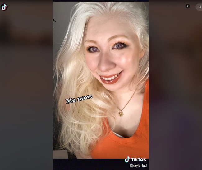 Beberapa orang benar-benar terganggu karena mereka atensi yang didapatkan dari kulitnya yang terlalu putih, warna mata berbeda, dan menarik perhatian dalam keramaian tapi aku melihatnya sebagai kesempatan untuk bertemu orang dan mengobrol, kata Kayla/Foto: Instagram/TikTok @kayla_lud