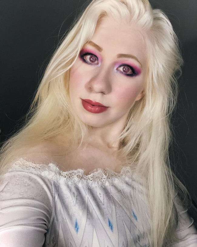 Kayla lahir dengan oculocutaneous albinism yang mempengaruhi warna kulit, mata, dan penghilatannya. Karena kondisi langka tersebut, Kayla tidak jarang mendapat komentar negatif dari orang-orang yang salah sangka bahwa ia ingin tampil mencuri perhatian.Foto: Instagram/TikTok @kayla_lud