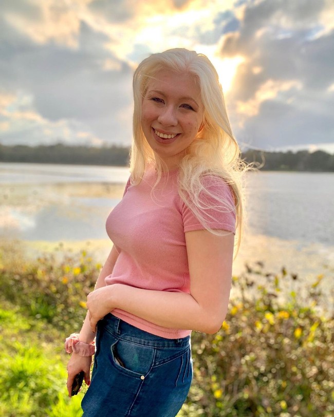 Orang-orang memang sering bertanya mengenai fisik Kayla, terutama mata. Kebanyakan menduga ia memakai kontak lensa atau filter karena warnanya tidak natural. Foto: Instagram/TikTok @kayla_lud