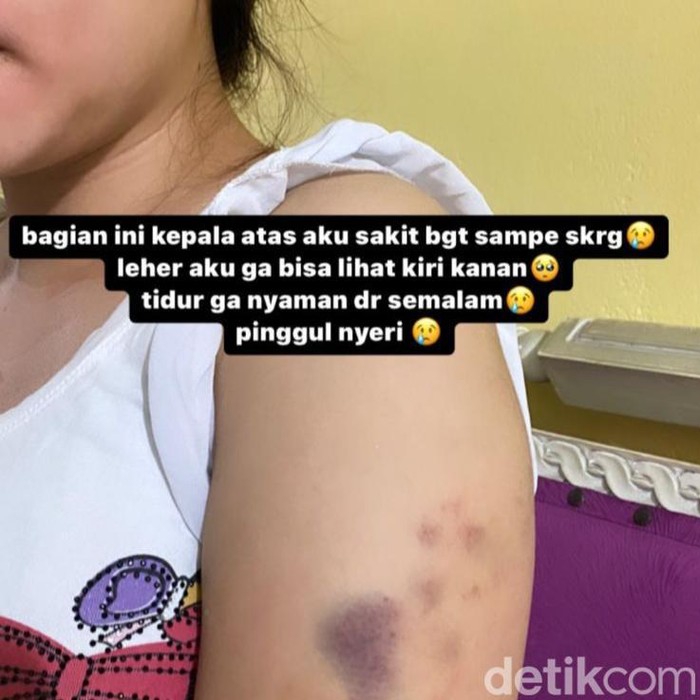 Korban disekap dan dianiaya polwan di Pekanbaru, Riau.