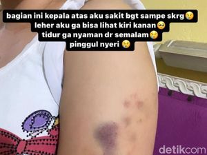 Babak Baru Polwan BNN Riau Aniaya-Sekap Pacar Adik Sendiri