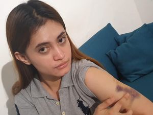 Dilaporkan ITE, Korban Disekap-Dipukuli Polwan Minta Perlindungan LPSK