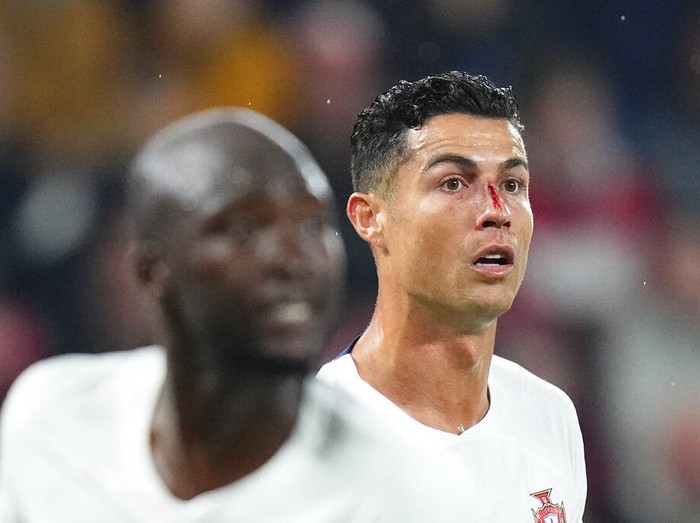 Portugal's Cristiano Ronaldo is treated on the pitch during the UEFA Nations League soccer match between the Czech Republic and Portugal at the Sinobo stadium in Prague, Czech Republic, Saturday, Sept. 24, 2022. (AP Photo/Petr David Josek)