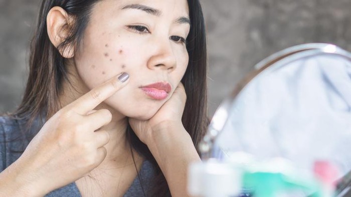 Bikin Wajah Glowing! 7 Makanan Ini Ampuh untuk Pudarkan Flek Hitam