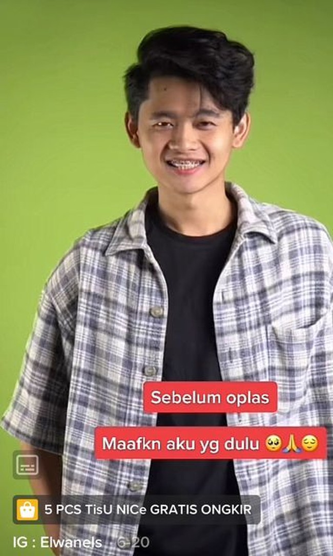 Menulis di unggahan TikTok melakukan operasi plastik, Elwan mengaku hanya konten. Dia belum menjalani operasi dan hanya berdandan menjadi wanita.  Foto: Dok. TikTok @sielwan_.