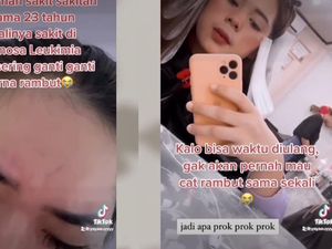 Gejala Awal Viral Wanita Bogor Kena Leukemia, Beneran gegara Cat Rambut?
