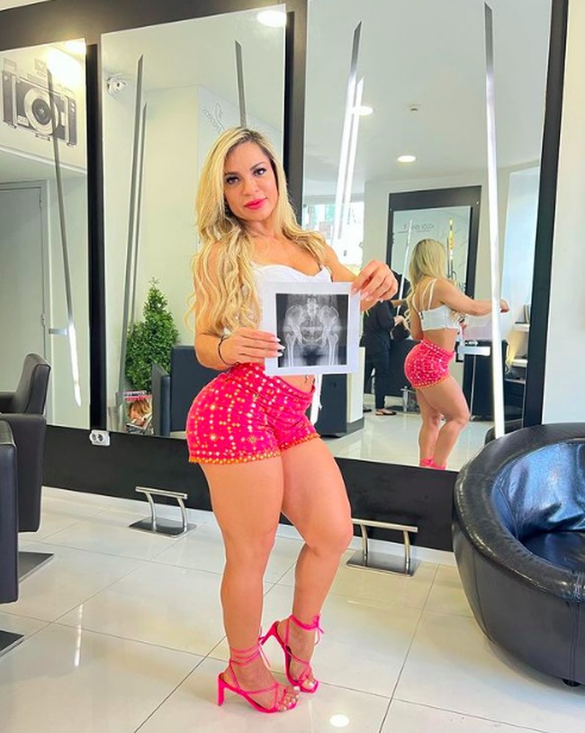 “Aku suka apa yang aku lakukan dan aku sudah lama ingin melindunginya. Karena aku memiliki kesempatan, aku pikir penting untuk mengasuransikan kakiku yang mendapat begitu banyak sorotan,” tambah Anne. Foto: dok. Instagram/@love_lifeanne