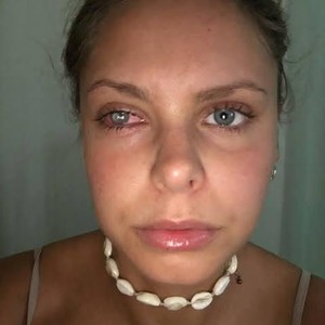 Gara-gara Tas Makeup Kotor, Mata Wanita Ini Bernanah Hingga Jadi Buta Gara-gara Tas Makeup Kotor, Mata Wanita Ini Bernanah Hingga Jadi Buta