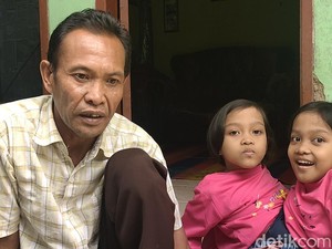 Ketabahan Iwan, Ayah yang Urus Bocah Kembar Dempet Garut