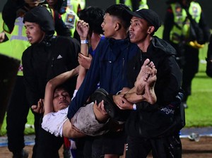Korban Tragedi Kanjuruhan: Patah Tulang, Sesak Nafas
