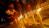 Disorot di Tragedi Kanjuruhan, Kenali Dampak Fatal Gas Air Mata ke Pernapasan