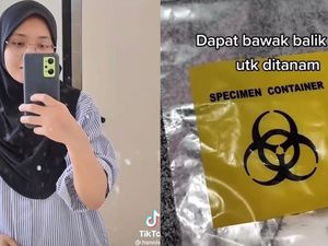 Viral Wanita 21 Tahun Nekat Cabut 4 Gigi Bungsu Sekaligus, Begini Pengalamannya