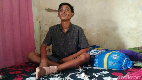 Saguwanto, korban selamat Tragedi Kanjuruhan