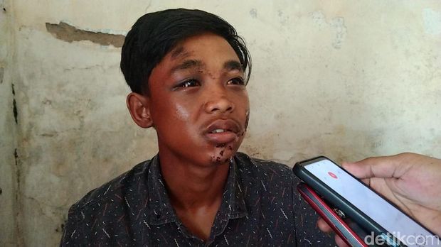 Saguwanto, korban selamat Tragedi Kanjuruhan