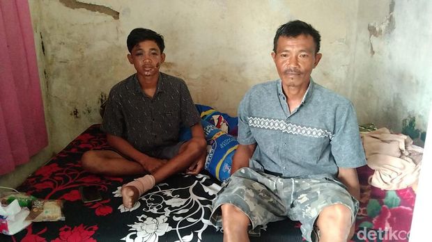 Saguwanto, korban selamat Tragedi Kanjuruhan