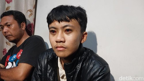 Kondisi mata Raffi yang memerah hingga kini