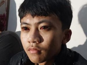 Korban Luka Tragedi Kanjuruhan Belum Tersentuh Bantuan Pemerintah