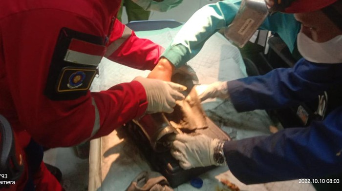 Tim pemadam kebakaran Pemkab Klaten mengevakuasi jari terjepit mesin