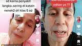 Viral Wanita di Bekasi Mengaku Idap Progeria, Sejak SD Sudah Seperti Nenek-nenek