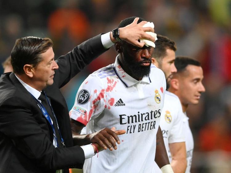 Tradisi Bek Real Madrid Berdarah-darah
